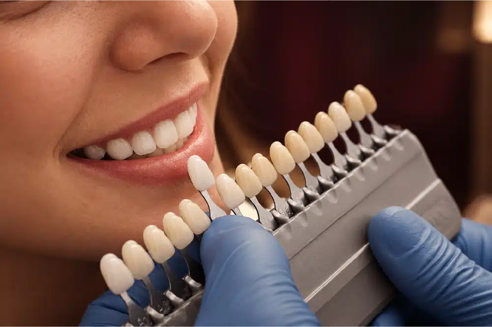 Dentística e Estética Dental