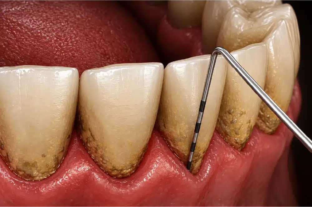 Periodontia
