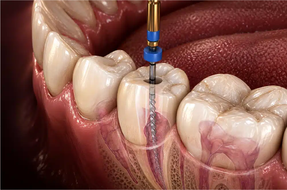 Endodontia